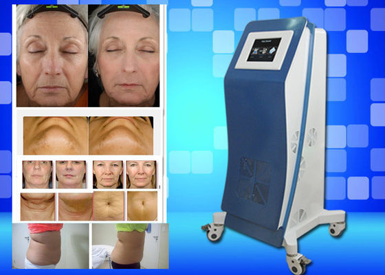 レーザー Lipo 装置の重量を凍らせている Cryo は家の美機械を失います